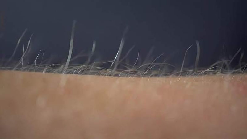 皮膚毫毛重，說明雄激素旺盛？